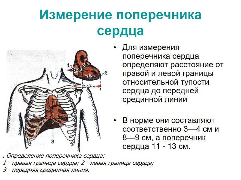 Измерение поперечника сердца  Для измерения поперечника сердца определяют расстояние от правой и левой